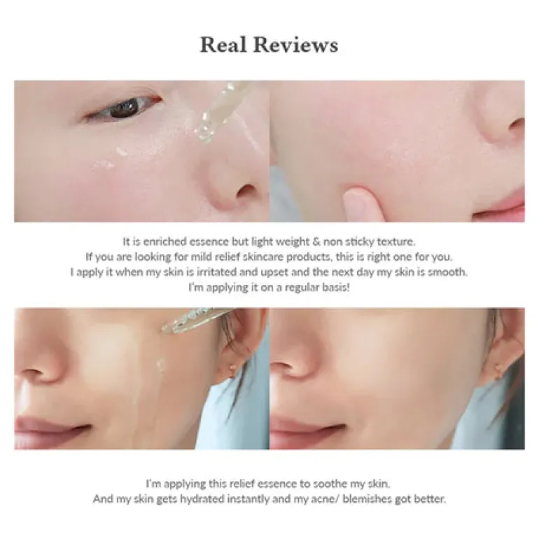 Skin Relief Essence