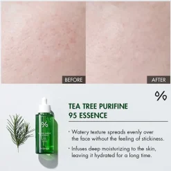 Tea Tree Purifine 95 Essence